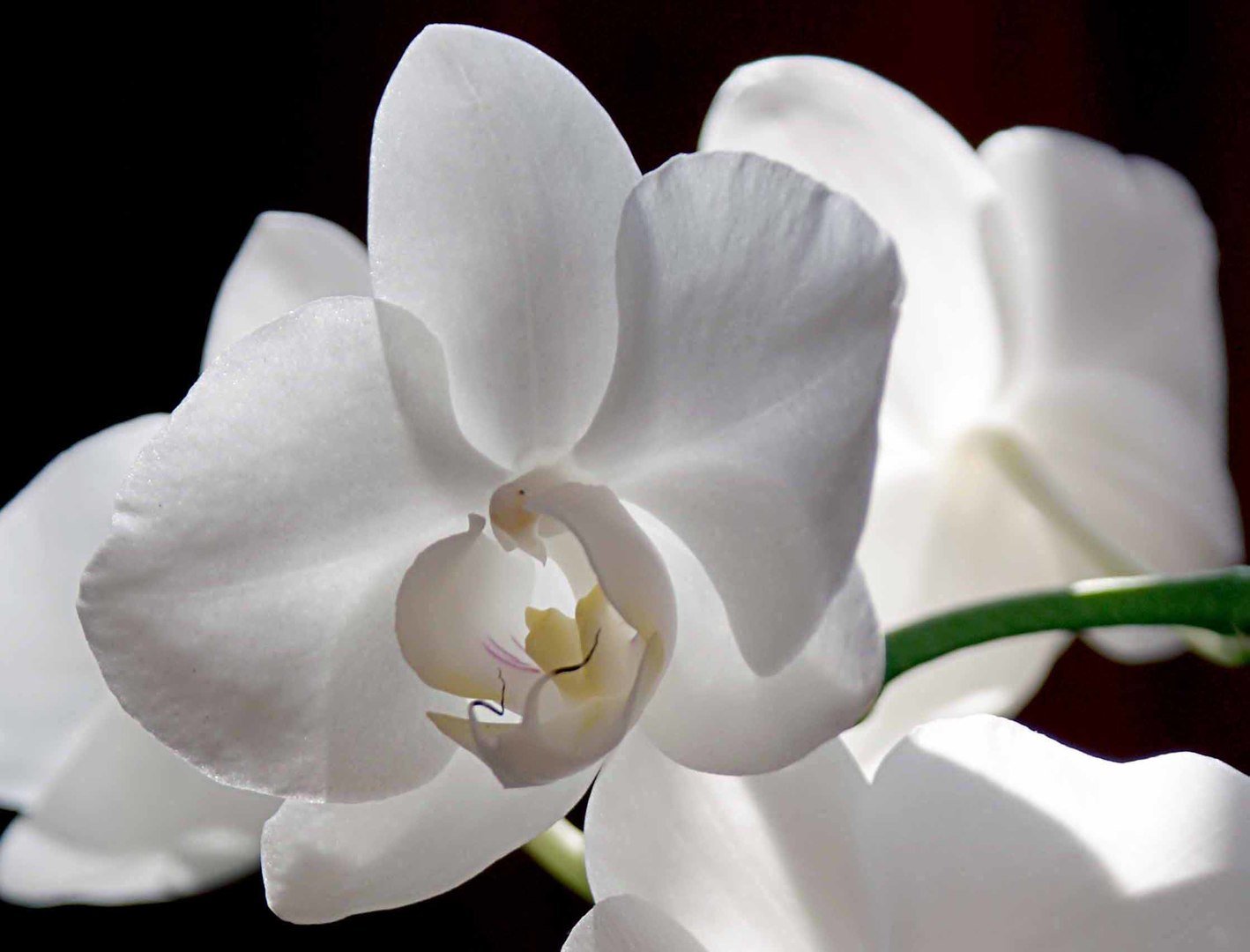 Белая Орхидея Стоматология Йошкар Ола